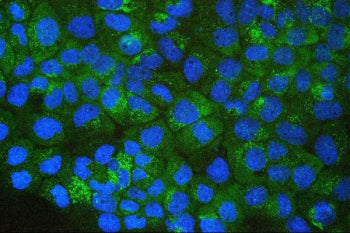 Immunofluorescent staining of FFPE human A431 cells with SQSTM1 antibody (green) and DAPI (blue). HI