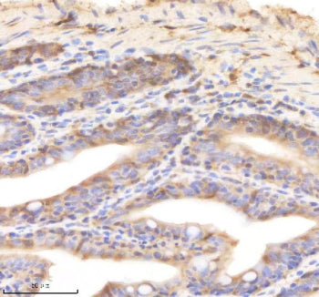IHC staining of zebrafish Psmd8 protein using Zebrafish Psmd8 antibody, HRP-labeled secondary and DA