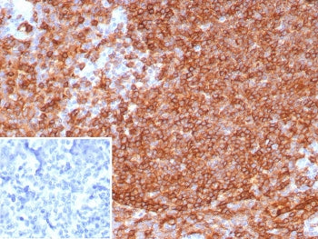 IHC staining of FFPE human tonsil tissue with HLA-DR antibody (clone HLA-DRA/8287R). Inset: PBS inst