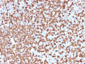 IHC staining of FFPE human spleen tissue with CD74 antibody (clone LN-2). HIER: boil tissue sections