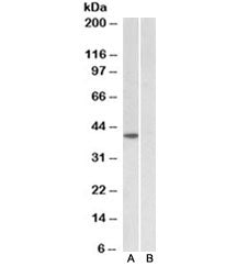 TBP Antibody