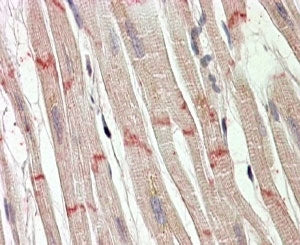 IHC testing of FFPE human heart with Desmoplakin antibody at 4ug/ml. HIER: steamed with pH6 citrate 