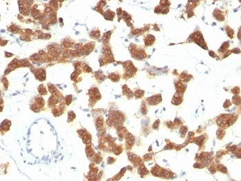 Cytokeratin 18 Antibody