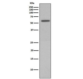 Western blot testing of lysate from Calyculin A-treated HeLa cells with phospho-Vimentin antibody (p