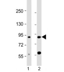 Western blot testing of human 1) brain and 2) HL-60 cell lysate with CCDC144A antibody at 1:2000. Pr