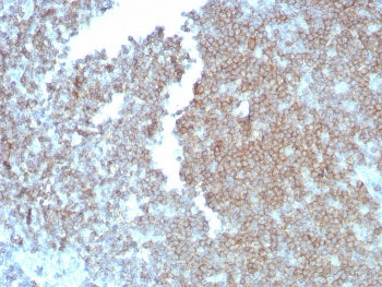 IHC staining of FFPE human lymph node tissue with CD27 antibody (clone LPFS2/8838R). HIER: boil tiss