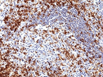 CD5 Antibody