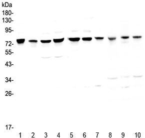 PARN Antibody