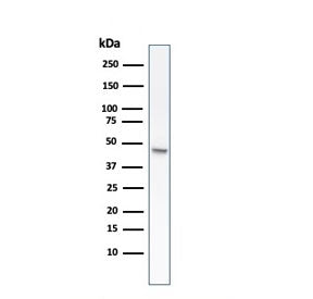 Western blot testing of human HCT-116 cell lysate with recombinant CK8 antibody (clone rB22.1).