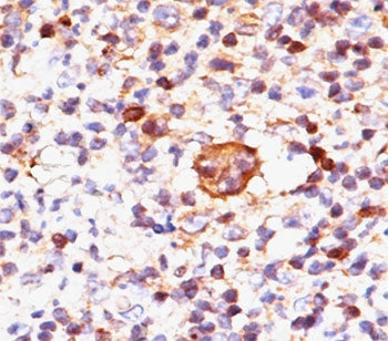 Bax Antibody
