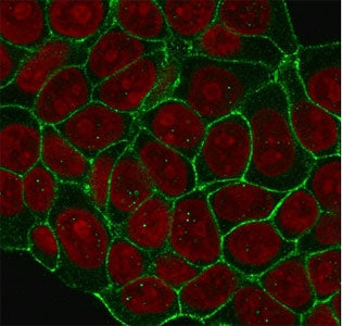 Immunofluorescent staining of human MCF7 cells with HER2 antibody (clone 2KRI7, green) and Reddot nu