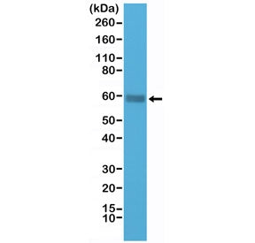 Western blot testing of human Jurkat cell lysate with recombinant CD5 antibody at 1:1000 dilution. O