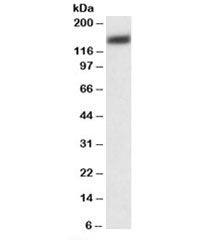 Western blot testing of HeLa lysate with PMCA1 antibody at 0.03ug/ml. Predicted molecular weight: ~1