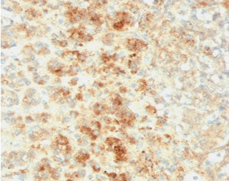IHC testing of FFPE human adrenal tissue with recombinant Perilipin 2 antibody (clone ADPN1-2R). Req