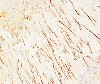 IHC-P testing of rat brain tissue with MAP2 antibody. HIER: Boil the paraffin sections in pH 6, 10mM