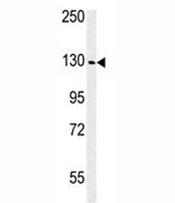 Western blot analysis of IGF1R antibody and WiDr lysate. Predicted molecular weight: ~200 kDa (pro),