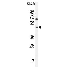 Western blot testing of human NCI-H460 cell lysate with C12orf29 antibody. Predicted molecular weigh