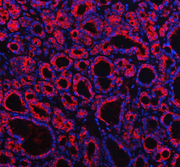Western blot testing of Profilin 2 antibody and rat brain lysate. Expected/observed size ~15 kDa.