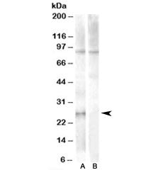 Western blot testing of human heart lysate with APOBEC2 antibody at 1ug/ml with [B] and without [A] 