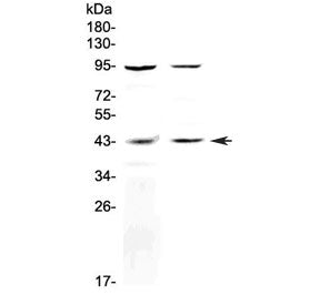 Western blot testing of human 1) WISH and 2) HepG2 cell lysate with GPR54 antibody at 0.5ug/ml. Pred