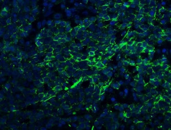 Claudin 1 Antibody / CLDN1