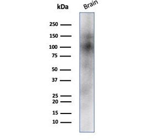 Western blot testing of human brain tissue lysate with CD56 antibody (clone NCAM/7523). Predicted mo