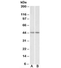 Western blot testing of human [A] and mouse [B] heart lysates with CKM antibody at 0.03ug/ml. Predic