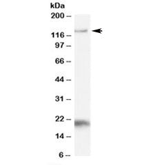 HTATSF1 Antibody
