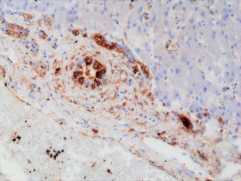 IHC staining of FFPE human liver tissue with recombinant GST pi antibody at 1:20,000.