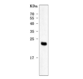 Western blot testing of human placental tissue with PP14 antibody. Predicted molecular weight ~21 kD