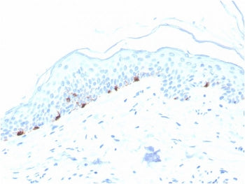 IHC staining of FFPE human skin with Tyrosinase-Related Protein-1 antibody (clone TYRP1/3280). HIER: