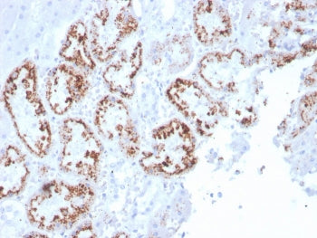 Retinol Binding Protein 4 Antibody / RBP4