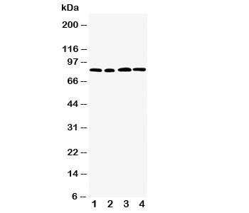 Western blot testing of CD168 antibody and Lane 1: MM231; 2: MM453; 3: HeLa; 4: A549 cell lysate. Ex