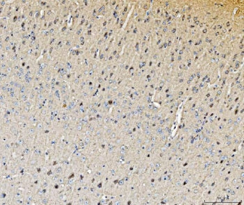 IHC staining of FFPE mouse brain tissue with Histidine decarboxylase antibody. HIER: boil tissue sec