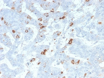 IHC staining of FFPE human colon tissue with recombinant MUC2 antibody (clone MLP/2970R). HIER: boil