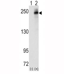 Western blot analysis of ALK antibody and 293 cell lysate (2 ug/lane) either nontransfected (Lane 1)
