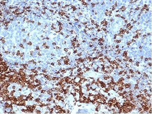 IHC staining of FFPE human tonsil tissue with recombinant CD3e antibody (clone C3e/4652R) at 2ug/ml in PBS for 30min RT. HIER: boil tissue sections in pH 9 10mM Tris with 1mM EDTA for 20 min and allow to cool before testing.