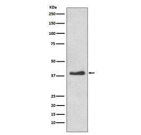 Western blot testing of human HeLa cell lysate with DKK1 antibody. Expected molecular weight: 26-40 