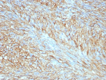 c-Kit Antibody / CD117 / SCFR