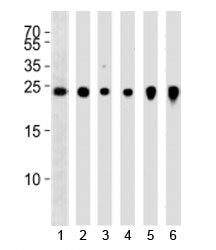 Western blot analysis of lysate from 1) NCI-H460, 2) U266, 3) mouse Neuro-2a, rat 4) PC-12 and 5) C6