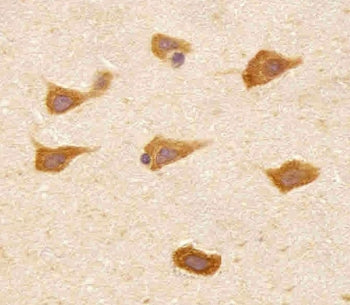 IHC testing of FFPE human brain tissue with PREX1 antibody. HIER: steam section in pH6 citrate buffe