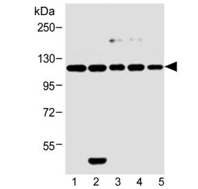 Western blot testing of human 1) MCF-7, 2) HeLa, 3) SH-SY5Y, 4) 293T and 5) rat PC-12 cell lysate wi