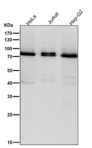 All lanes use the Pan-PKC antibody at 1:2000 dilution for 1 hour at room temperature. Expected molec