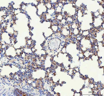 IHC staining of FFPE mouse lung tissue with VE Cadherin antibody. HIER: boil tissue sections in pH8 