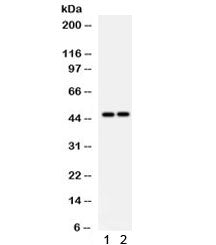 Western blot testing of human 1) HeLa and 2) Jurkat lysate with PTPN2 antibody. Predicted/observed m