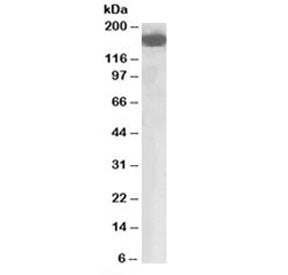 Western blot testing of human lung lysate with CFH antibody at 0.03ug/ml. Predicted molecular weight