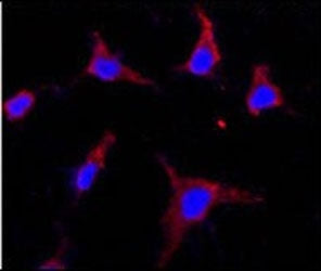Immunofluorescent staining of fixed and permeabilized human HeLa cells with CD133 antibody (red) and