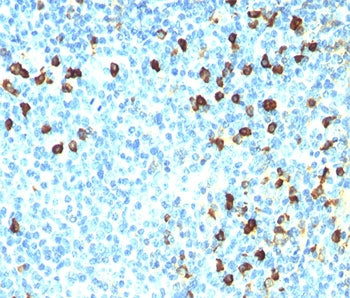 Lambda Light Chain Antibody / Lambda Antibody
