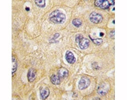 Claudin 1 Antibody (CLDN1) [Loop 1]