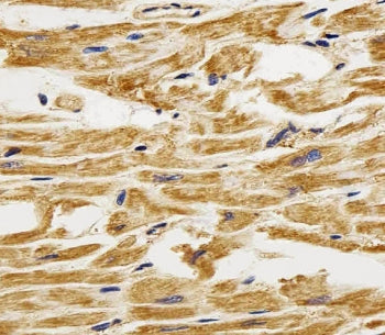 IHC testing of FFPE human heart tissue with FABP3 antibody. HIER: steam section in pH6 citrate buffe